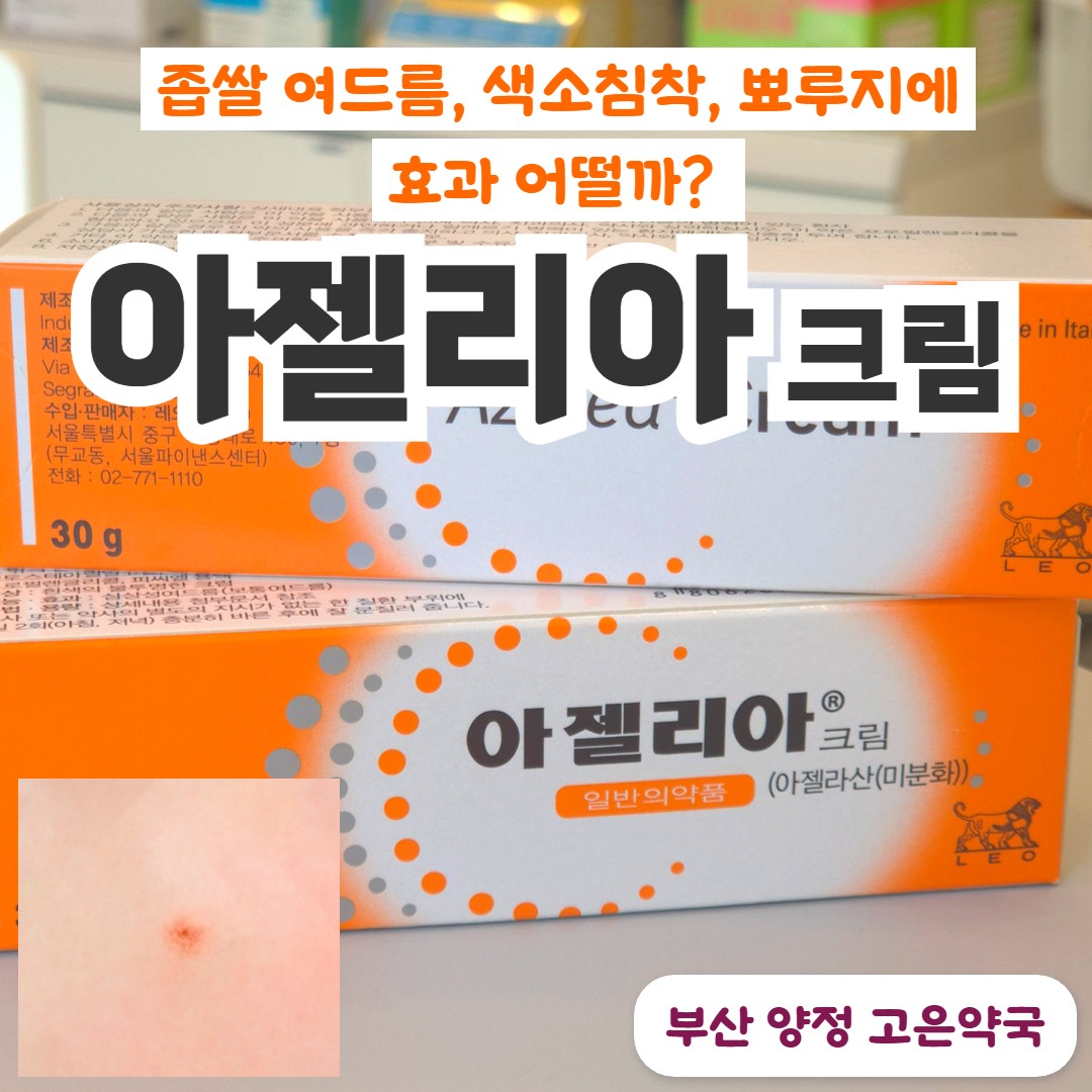 아젤리아크림 좁쌀 여드름 색소침착 효과, 약국 가격, 사용법, 부작용 따가움 후기