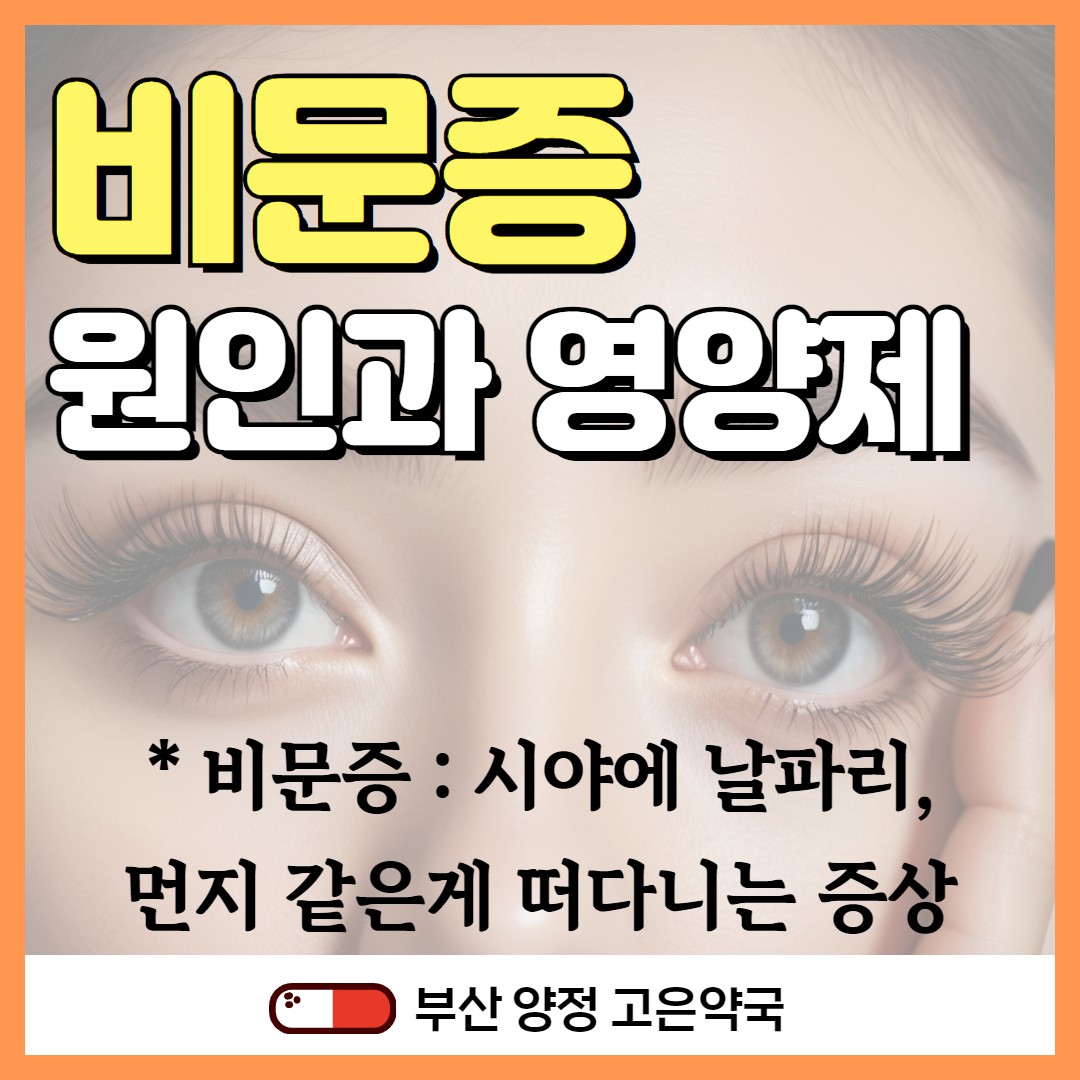 눈앞에 검은 점, 날파리가 떠다닌다면? 비문증의 원인과 영양제
