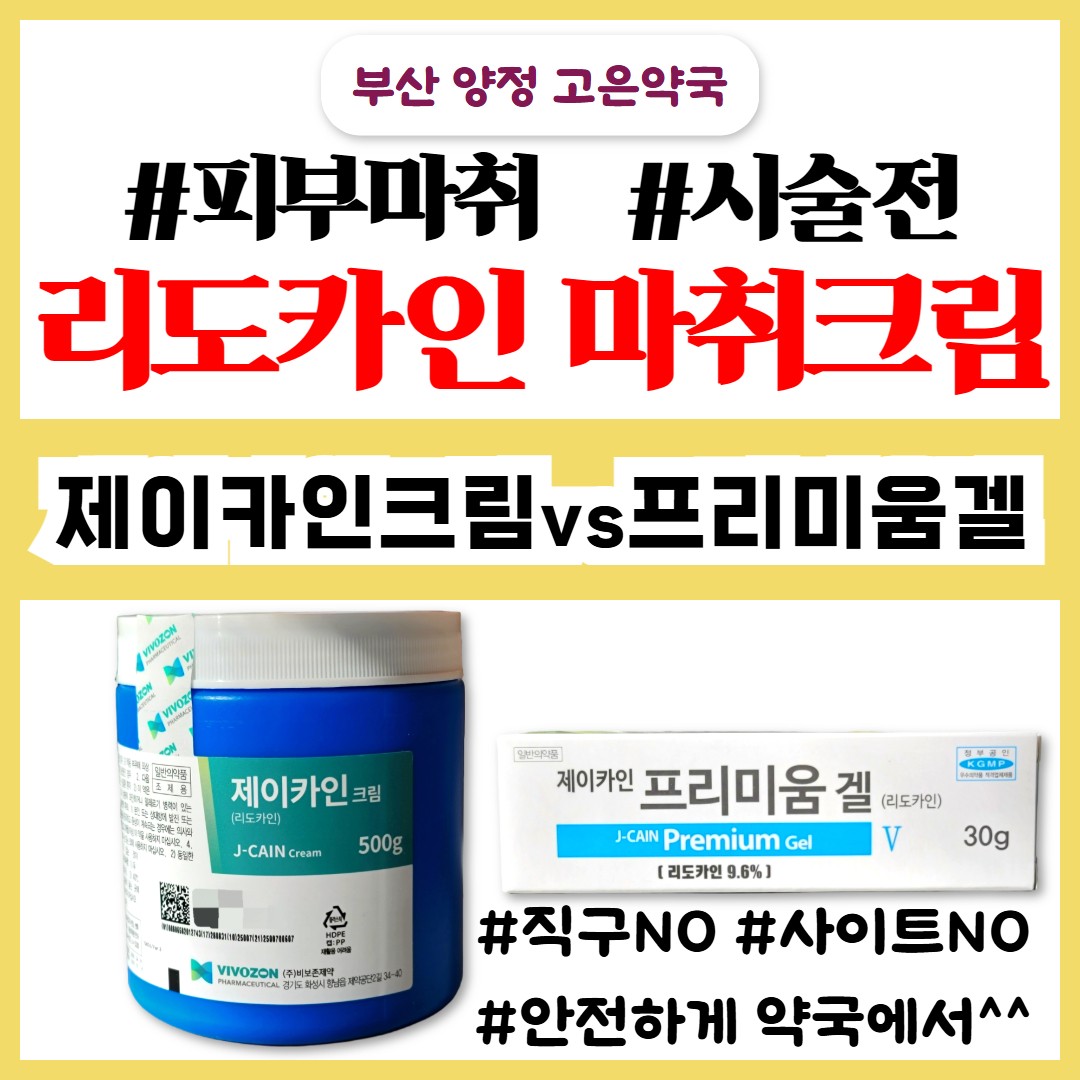 제이카인 크림 vs 제이카인 프리미움겔, 리도카인 약국 마취크림 효과 사용방법