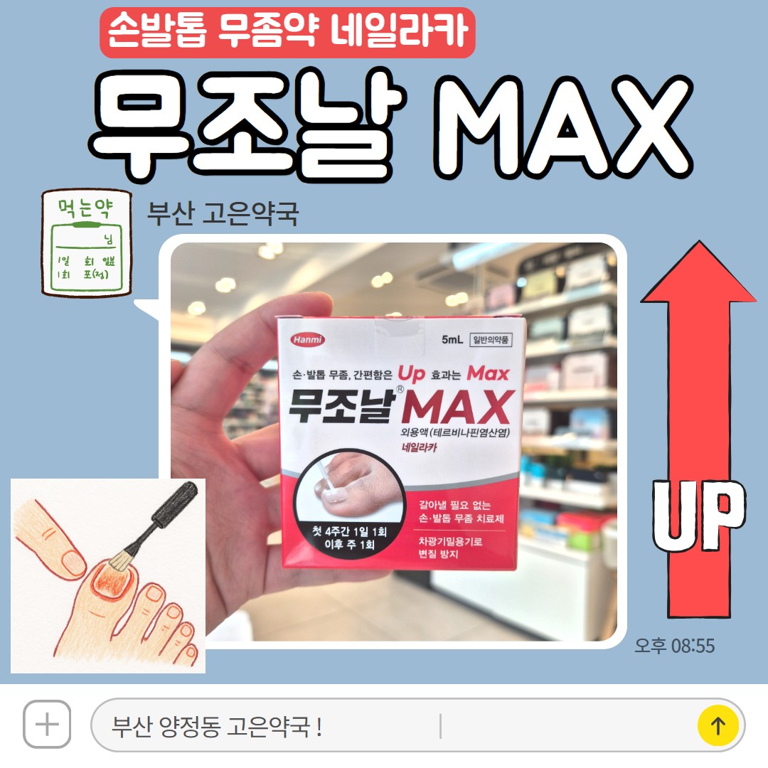 무조날맥스, 손톱 발톱 무좀약 테르비나핀 네일라카 구매방법 가격